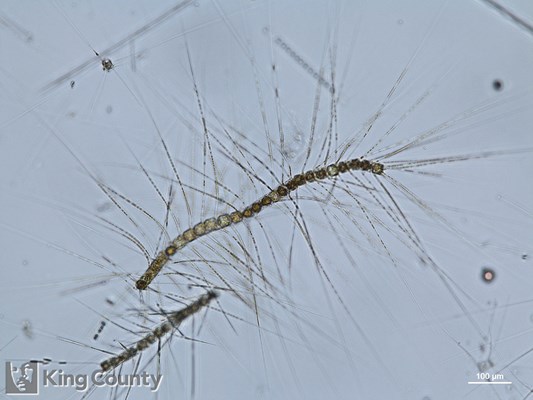 Photo of Chaetoceros convolutus